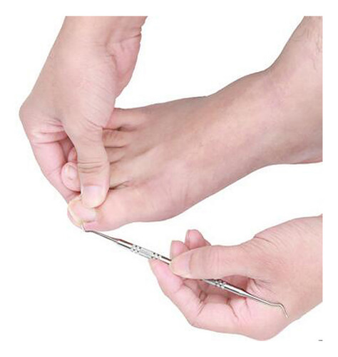 Set De Corrección De Uñas Encarnadas, Tratamiento Para Uñas