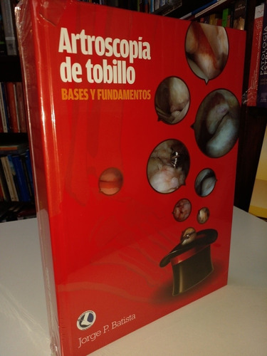 Artroscopia Del Tobillo Bases Y Fundamentos Batista