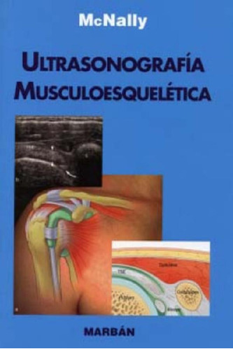 Libro - Ultrasonografia Musculoesquelético - Residente - Mc