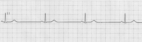 Papel P/ Electrocardiógrafo 45mmx30mts Cardio Charts X 10 U