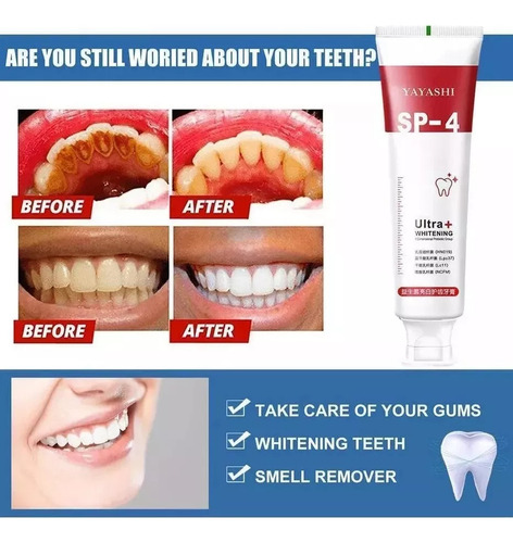 2025 Pasta Dental Blanqueadora Sp-4 Probióticos Fresh