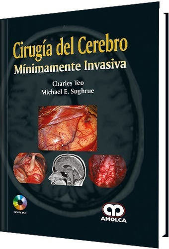 CIRUGÍA DEL CEREBRO MINIMAMENTE INVASIVA, de CHARLES TEO y se., vol. 1. Editorial Amolca, tapa dura en español, 2017