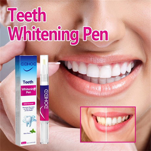 Blanqueamiento Dental E Lápiz Blanqueador Dental Blanqueamie