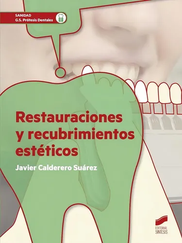 comprar Restauraciones Y Recubrimientos Estãâ©ticos (2ãâª Ediciãâ³n Revisada Y Ampliada), De Calderero Suárez, Javier. Editorial Síntesis S.a., Tapa Blanda En Español