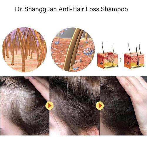 Xinnuo Shampoo Antiqueda De Cabelo E Crescimento Capilar 240