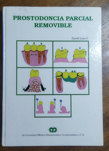 Libro Prostodoncia Parcial Removible
