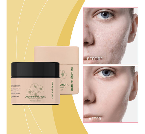 Pomada De Jasmim Para Olhos 100 Ml Com Olheiras Creme Para O