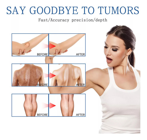 Productos Para El Cuidado De La Piel Lipoma Fatty Knot En Ae