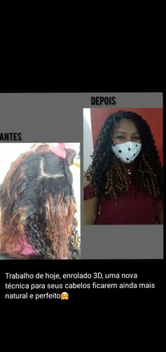 Imagem 4 de 5 de Estética