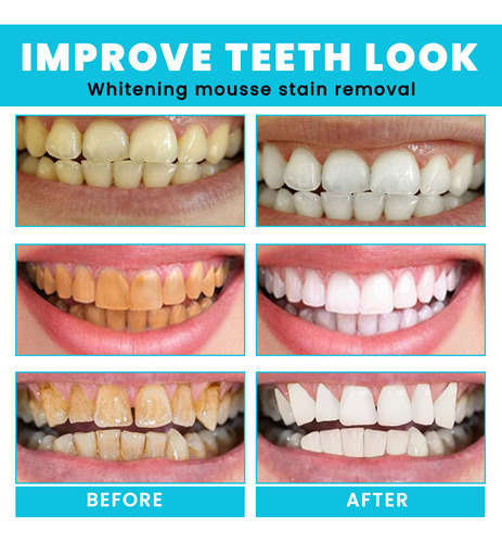 X Mouthwash Whitening Creme Dental Branqueador De Dentes 600