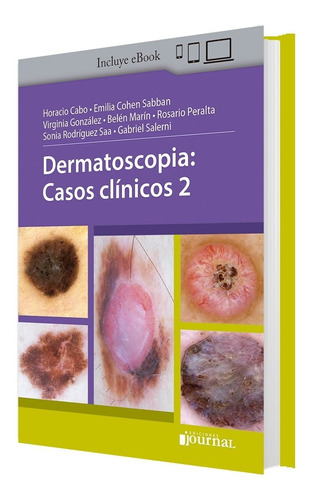 Dermatoscopia Casos Clinicos 2
