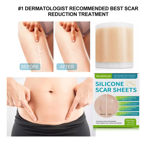Silicona Cicatriz Abdominoplastia Dermo Cesarea Post Parto