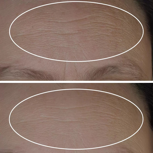 Plum Smooth Serum Rellenador De Lineas 45 Ml Strivectin Momento De Aplicación Día/noche Tipo De Piel Mixta