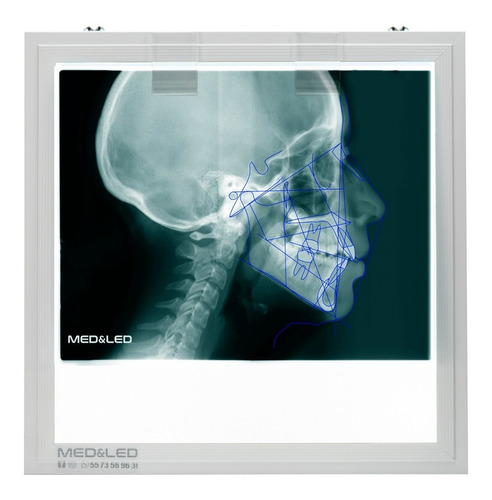 Negatoscopio Dental Led 30x30 Lateral De Craneo, Panoramica