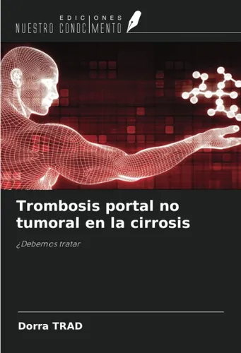 Libro: Trombosis Portal No Tumoral En La Cirrosis: ¿debemos
