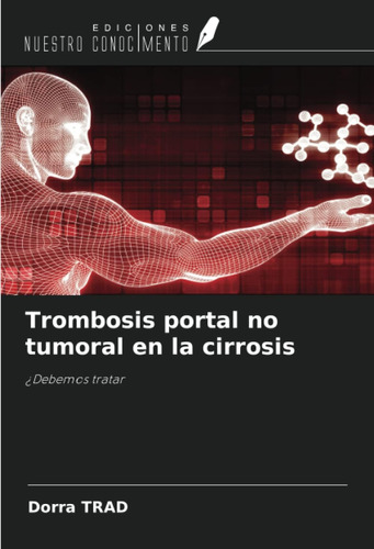 Libro: Trombosis Portal No Tumoral En La Cirrosis: ¿debemos 