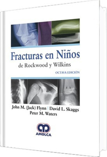 Fracturas En Niños De Rockwood Y Wilkins / Octava Edición