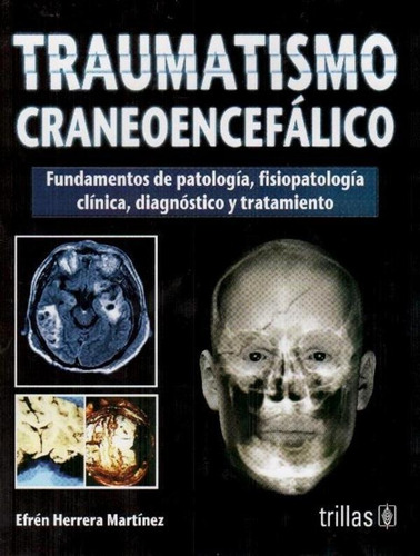 Traumatismo Craneoencefálico: Fundamentos De Patología, Fis