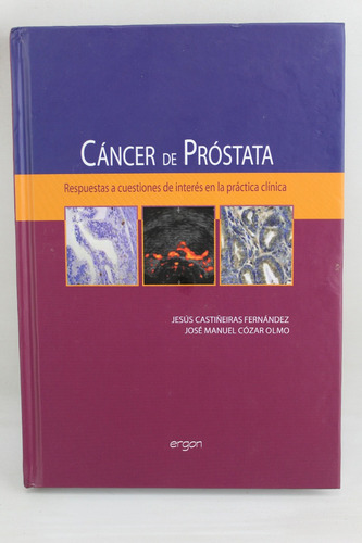 L3131 Jesus Castiñeiras Fernandez -- Cancer De Prostata