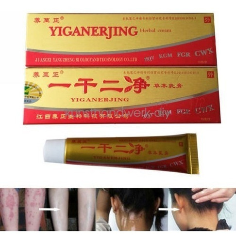Crema China Yiganerjing Psoriasis - Unidad a $29900