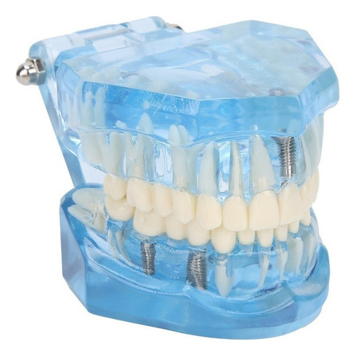 Youpin Dientes Dentales Modelo Acrílico Azul Transparente