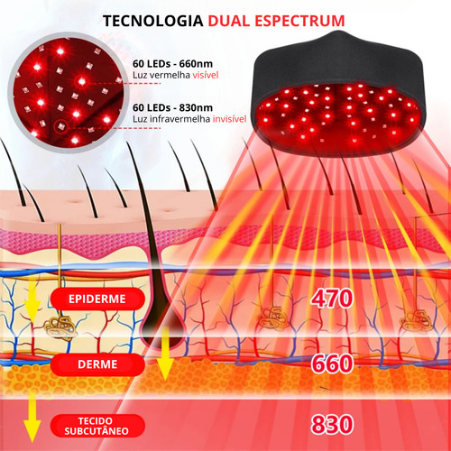 Capacete Laser Led Cresce Cabelo Antiqueda Tratamento Diodo