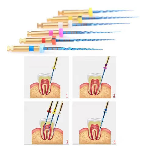 Kit Com 06 Limas Canal Rotatória Endodontica Sx-f3 21mm