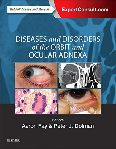 Diseases And Disorders Of The Orbit And Ocular Adnexa