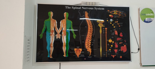 Tablero Sistema Nervioso Y La Columna Vertebral.