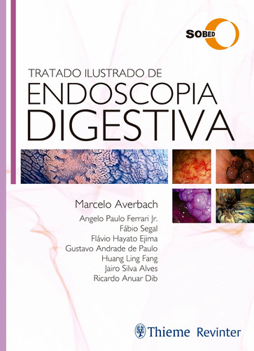 Tratado Ilustrado de Endoscopia Digestiva, de Averbach, Marcelo. Editora Thieme Revinter Publicações Ltda, capa dura em português, 2017