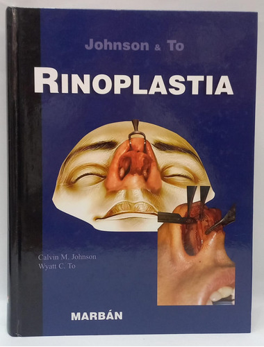 Libro Rinoplastia - Calvin M Johnson