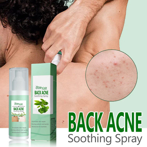 Spray Reparador Z Acned Mark Clean Back M 9006, 120 Ml