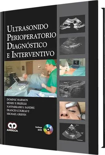 Ultrasonido Perioperatorio Diagnóstico E Interventivo