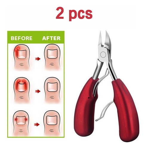 Cortauñas Del Dedo Del Pie Para Uñas Encarnadas O Gruesas