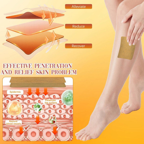 Tratamiento De Cúrcuma Para Aliviar Las Varices En Las Piern