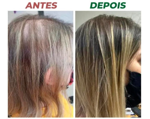 Shampoo Engrossa Fios Antiqueda Capicidil 300ml