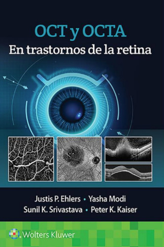 Ehlers. Oct Y Octa En Trastornos De La Retina 1 Ed.