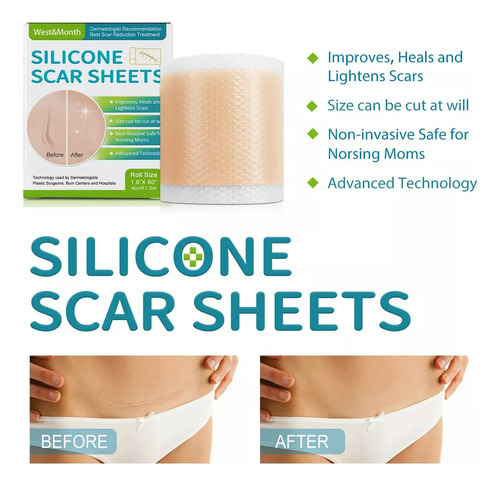 Silicona Cicatriz Abdominoplastia Dermo Cesarea Post Parto