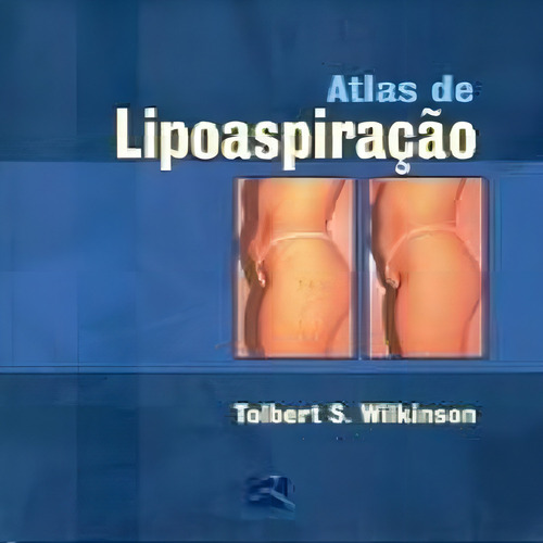 Livro: Atlas De Lipoaspiração