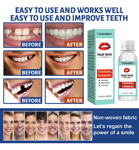 Pegamento Dental Temporal Multifuncional Para Rellenar Cavid