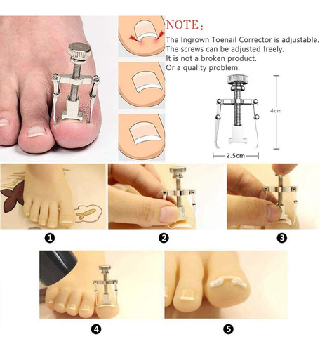 Kit De Herramientas Para Uñas Encarnadas.