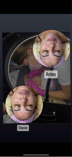 Estética Facial