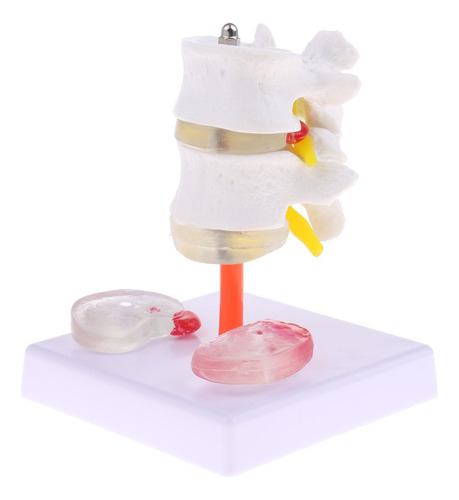 Vértebra Lombar Da Coluna Vertebral Humana 1: 1 Com Modelo