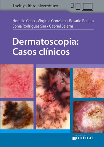 Dermatoscopia: Casos Clinicos - Cabo, Horacio