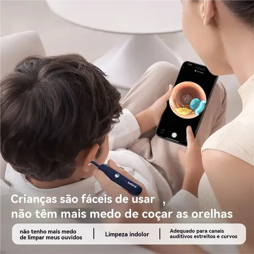 Câmera De Limpeza Visual Bebird * Zx Ear Wax | MercadoLivre
