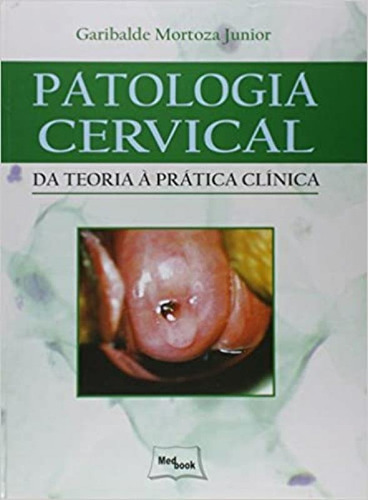 Patologia Cervical: Da Teoria À Prática Clínica, De Garibalde Mortoza Junior. Editora Medbook, Capa Mole Em Português
