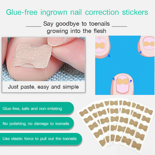 Parche Corrector De Uñas Para Cuidado Perfecto