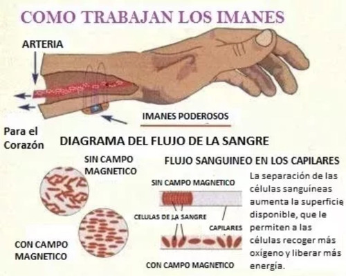 Kit De Magnetoterapia, 384 Imanes Para Multi Tratamientos!