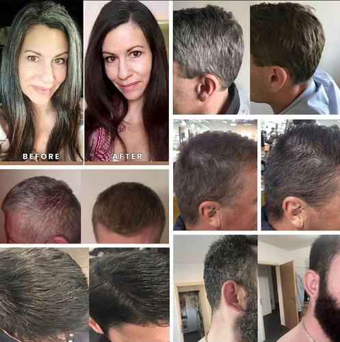 . 4x Shampoo Natural Stick Para Parar A Queda De Cabelo