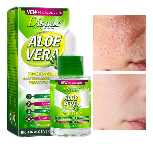 Sérum Facial De Aloe Vera Que Reduce Las Líneas Finas Y Las